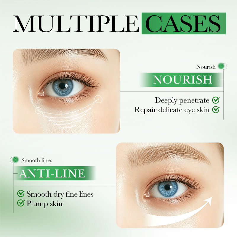 60 Stück SADOER Centella Asiat – Collagen Under Eye Patches Bewertung und Preis