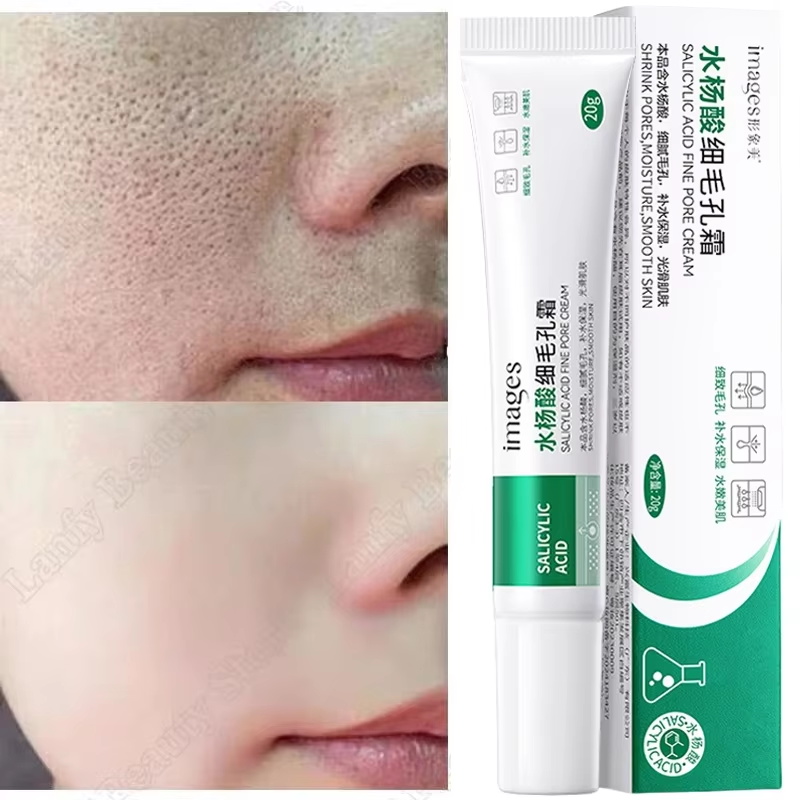 Salicylsäure Porenreinigungscr – Salicylic Acid Blackhead Remover Bewertung und Preis